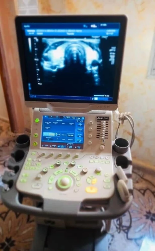 Echographe TOSHIBA APLIO 500