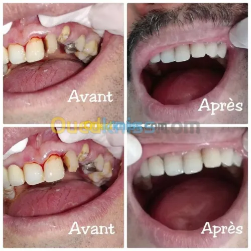 Chirurgien Dentiste ODF 9h00 a 00h00 bon ramadon