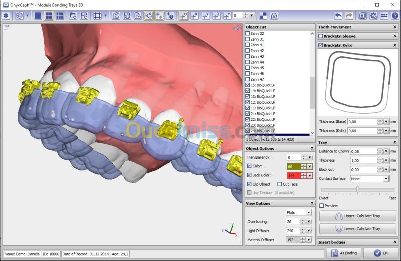 OnyxCeph 2026 Build 3.2.244(668) 17
