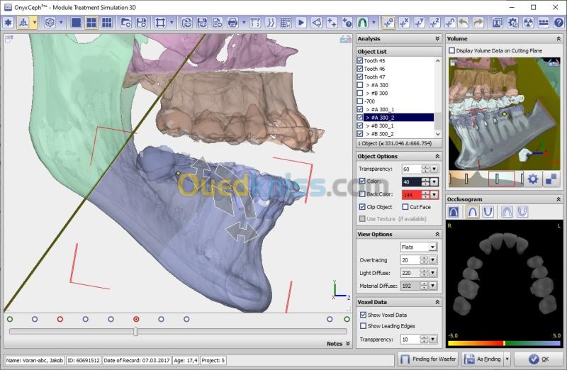 OnyxCeph 2026 Build 3.2.244(668) 15